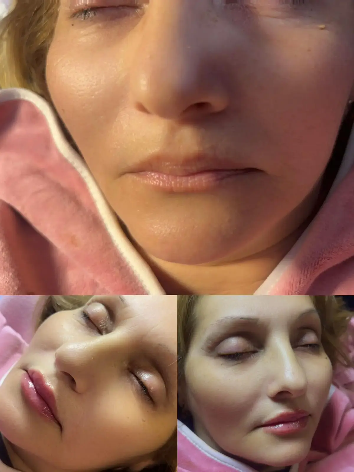 Szonja Beauty Salon – kezelés 7