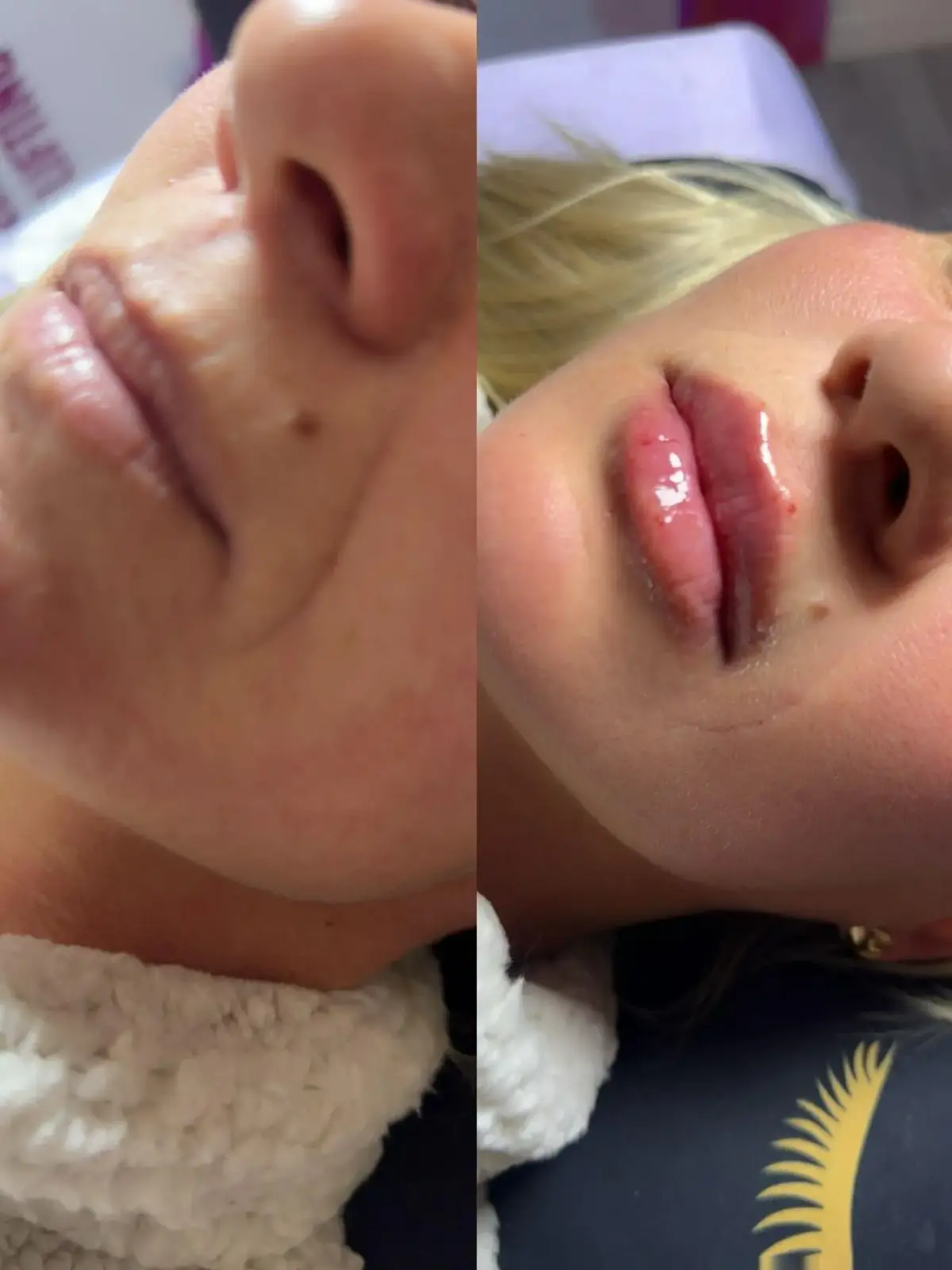 Szonja Beauty Salon – kezelés 8