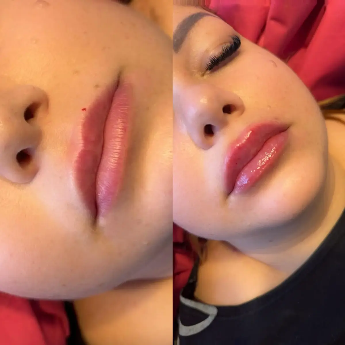 Szonja Beauty Salon – kezelés 9