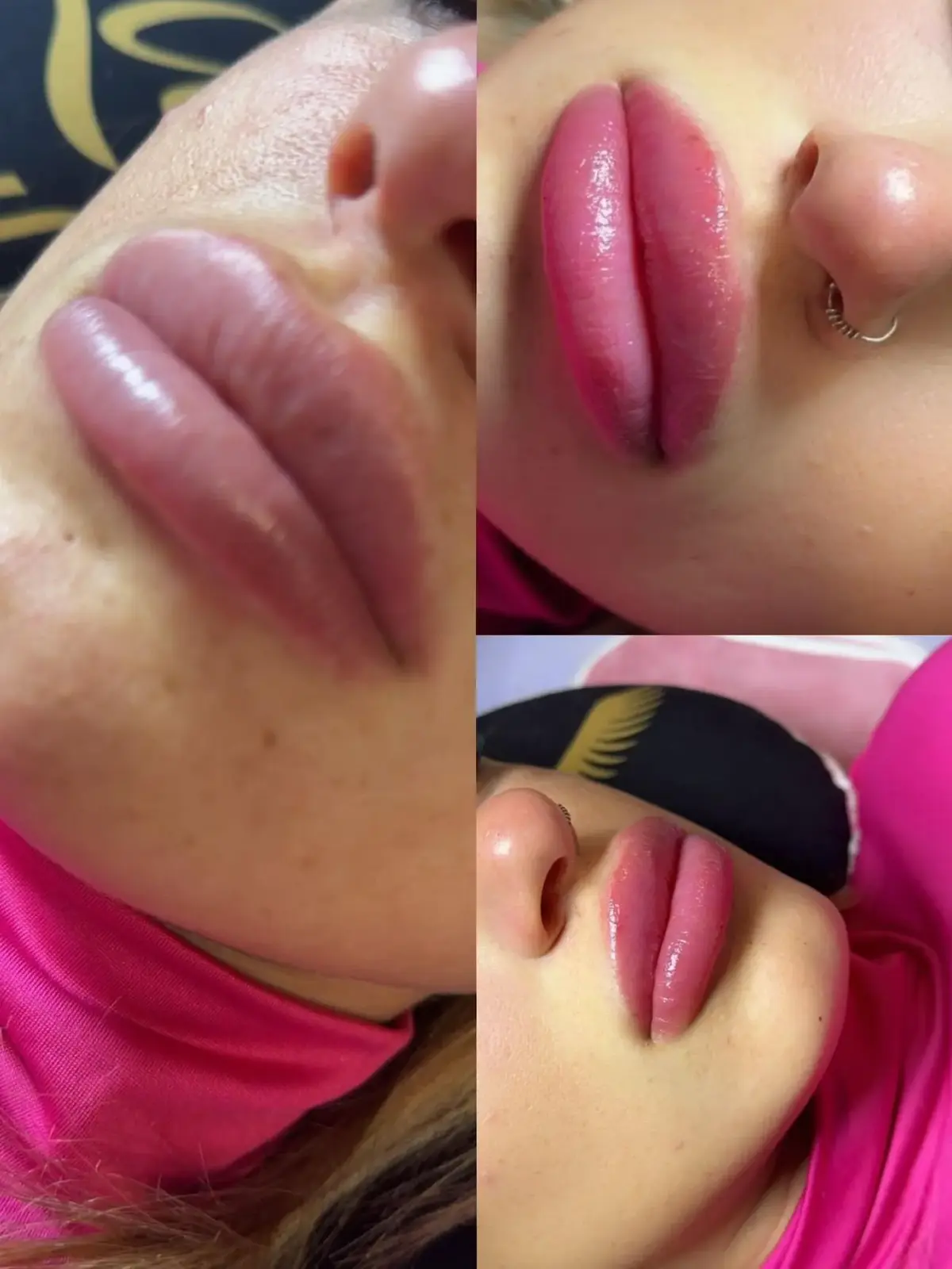 Szonja Beauty Salon – kezelés 10