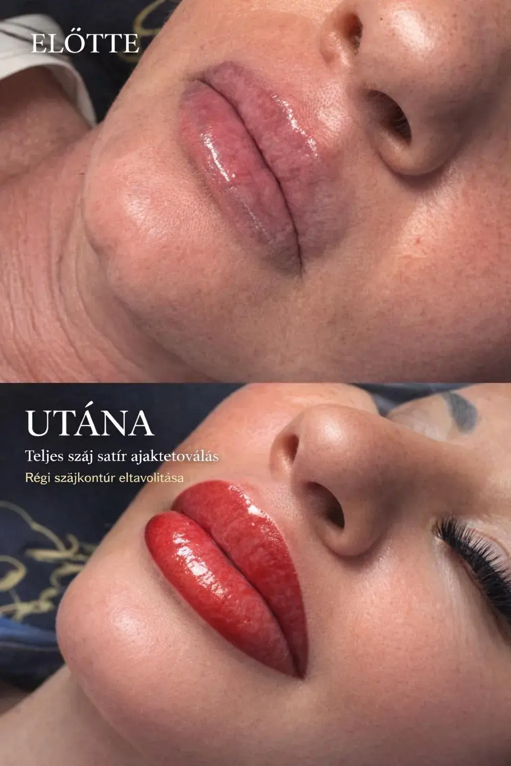 Szonja Beauty Salon – kezelés 11