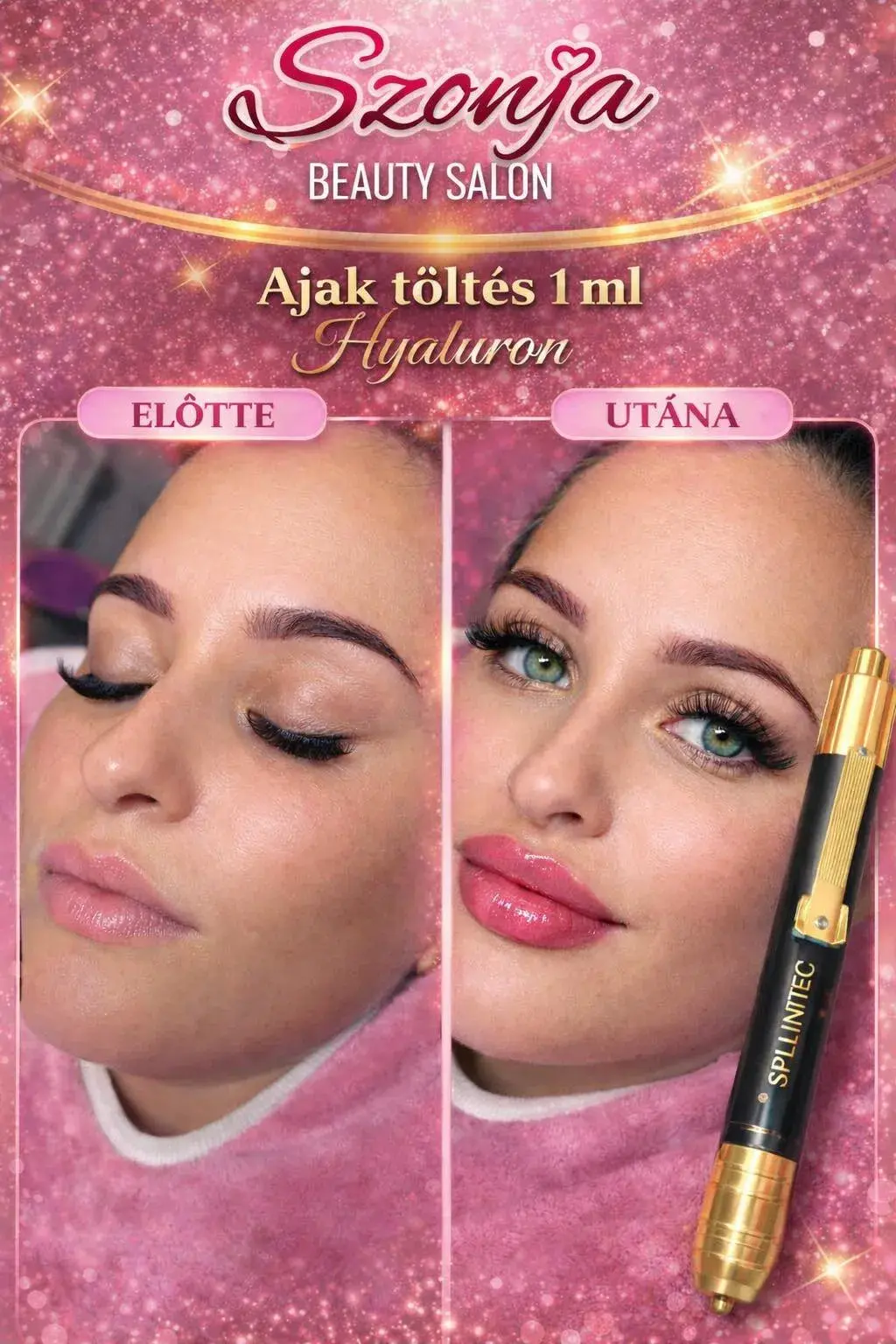 Szonja Beauty Salon – kezelés 12