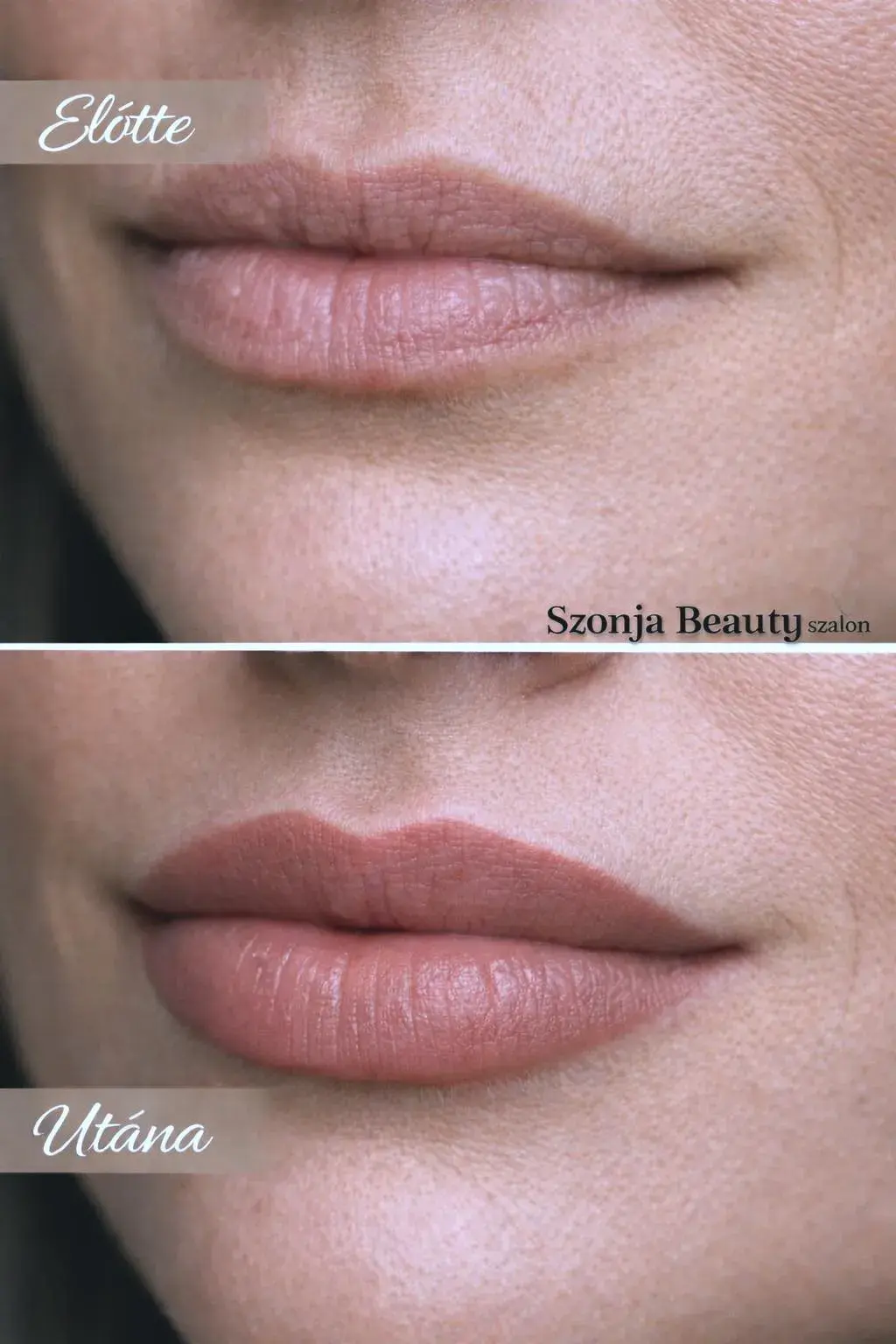 Szonja Beauty Salon – kezelés 16