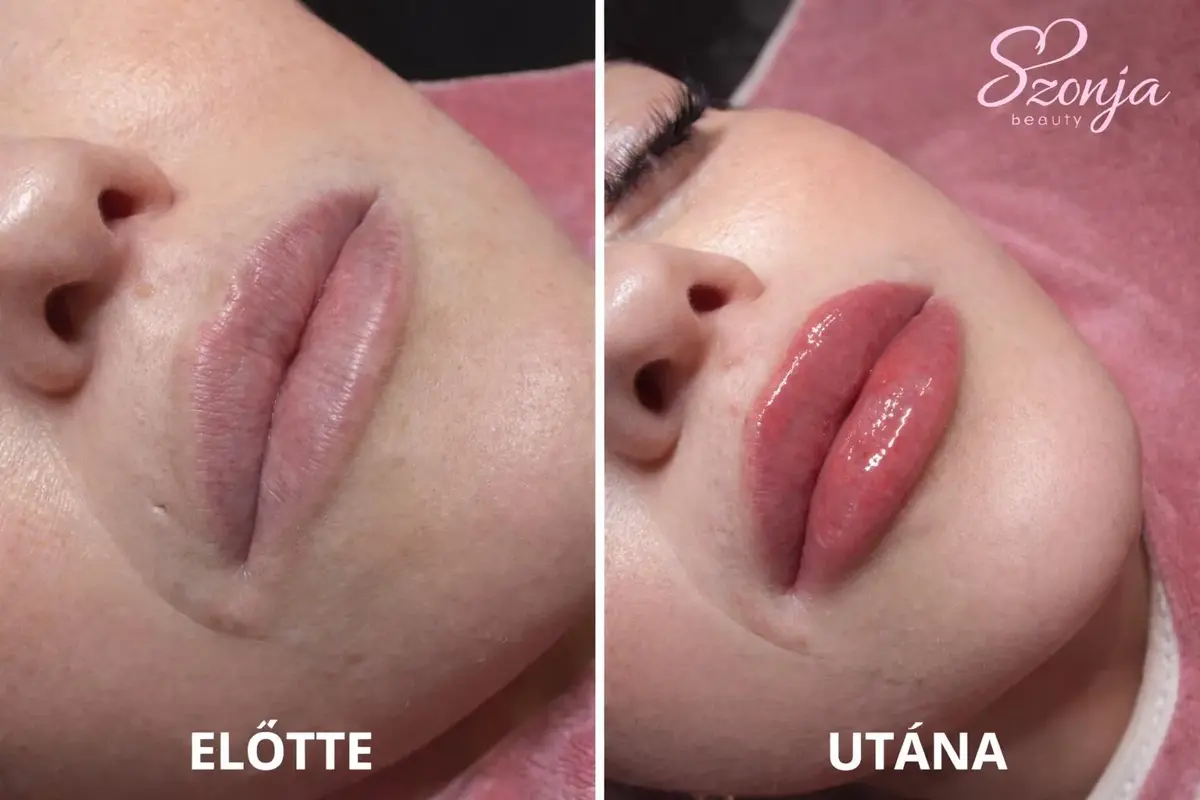 Szonja Beauty Salon – kezelés 17