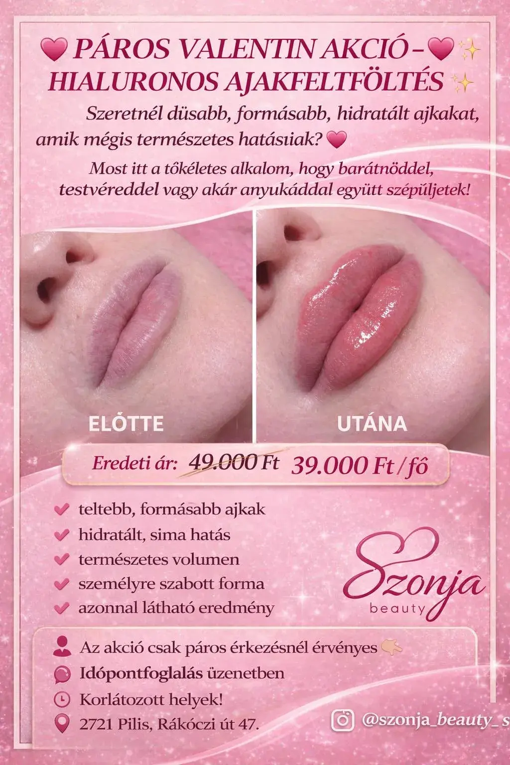 Szonja Beauty Salon – kezelés 20