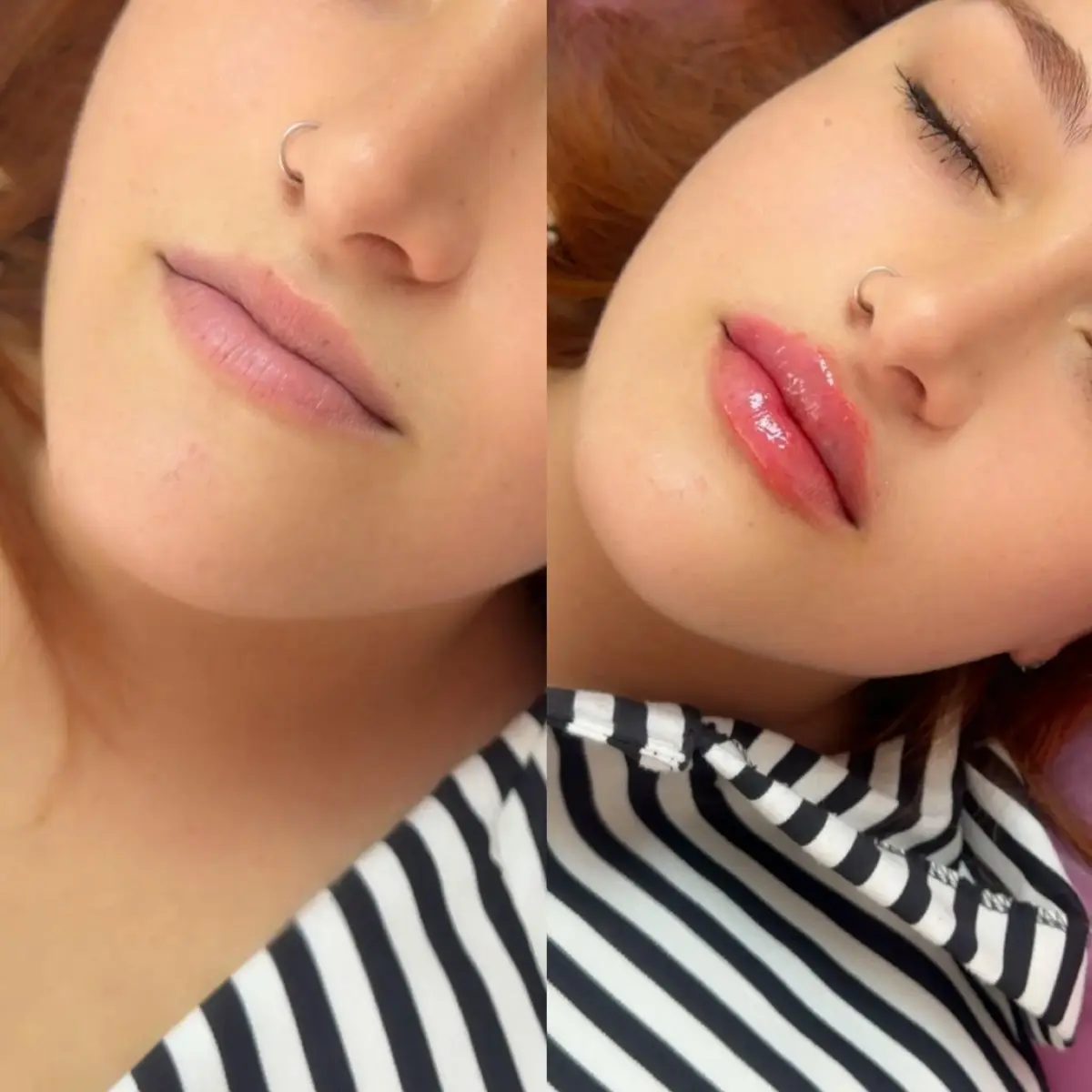 Szonja Beauty Salon – kezelés 28