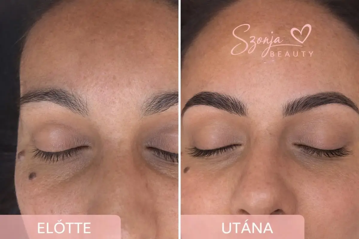 Szonja Beauty Salon – kezelés 29