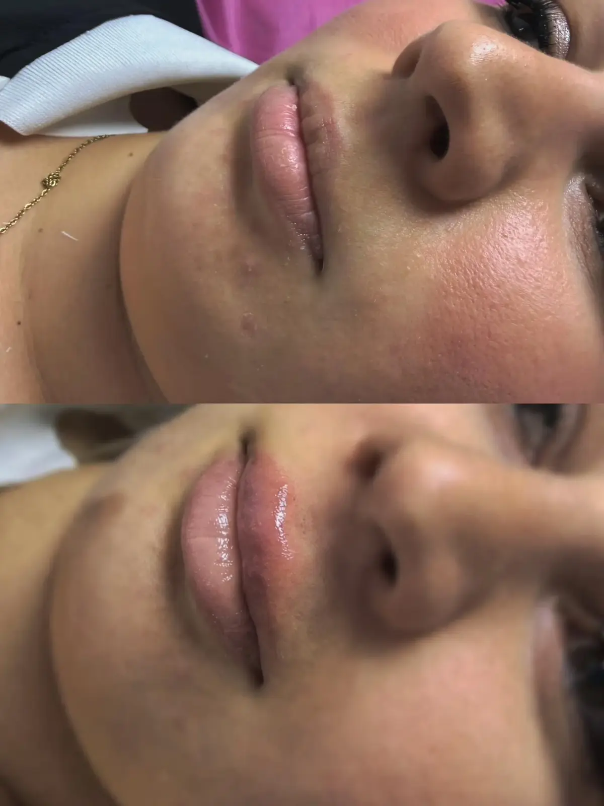 Szonja Beauty Salon – kezelés 31